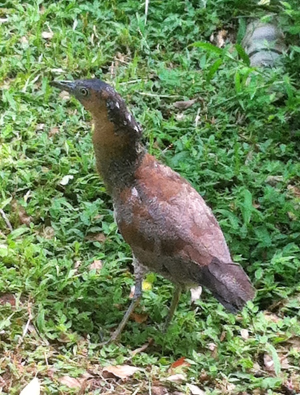 靜脈曲張, 水腫